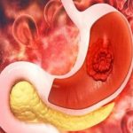 Mật ong cũng có tác dụng làm lành tổn thương và viêm trên niêm mạc đường hô hấp