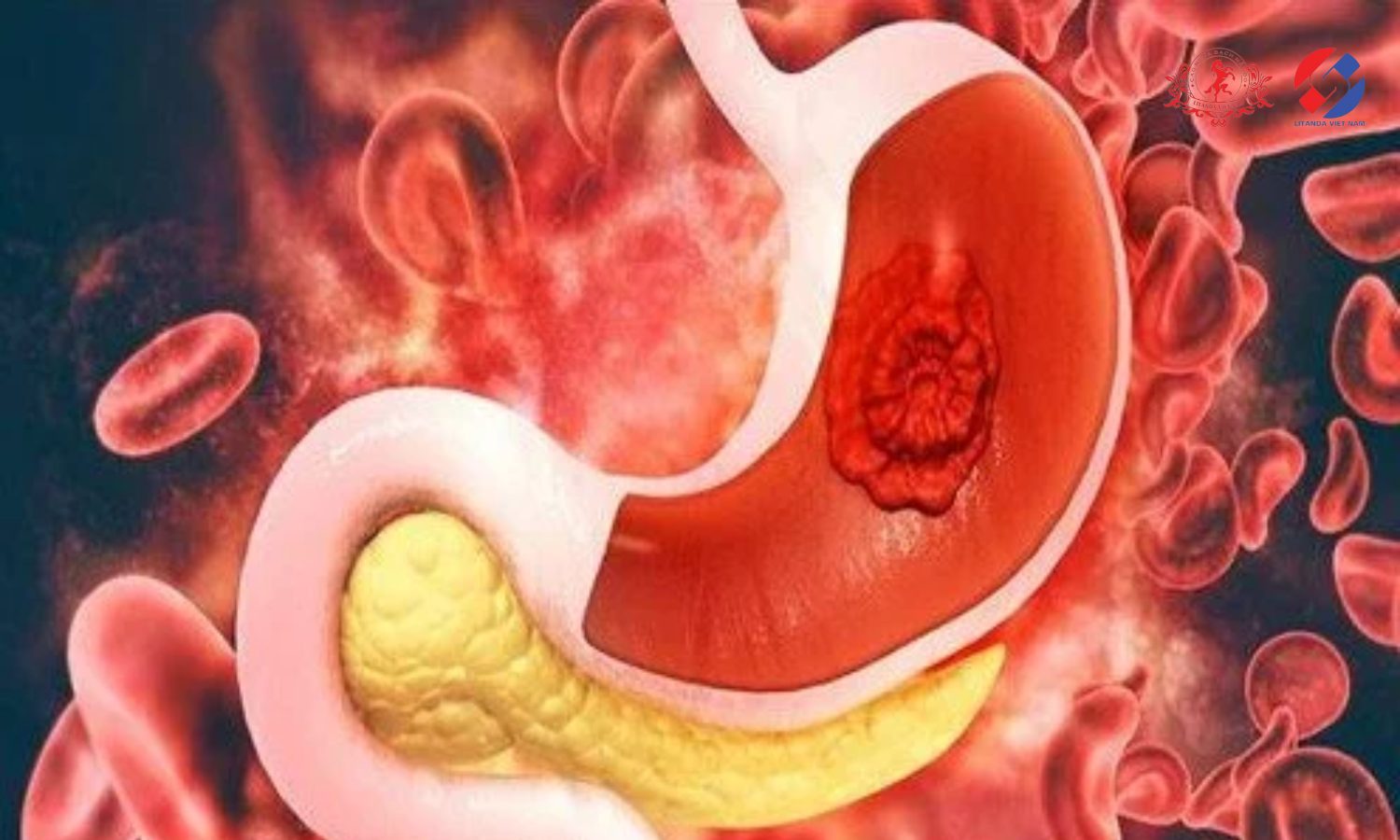 Mật ong cũng có tác dụng làm lành tổn thương và viêm trên niêm mạc đường hô hấp